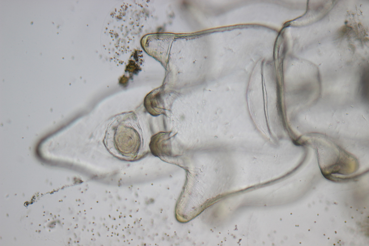Plankton Oostende. Zeester: brachiolaria / 100x